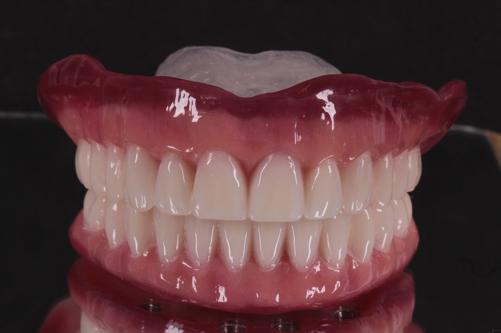 Prótese protocolo real fotografada pela Sorridi